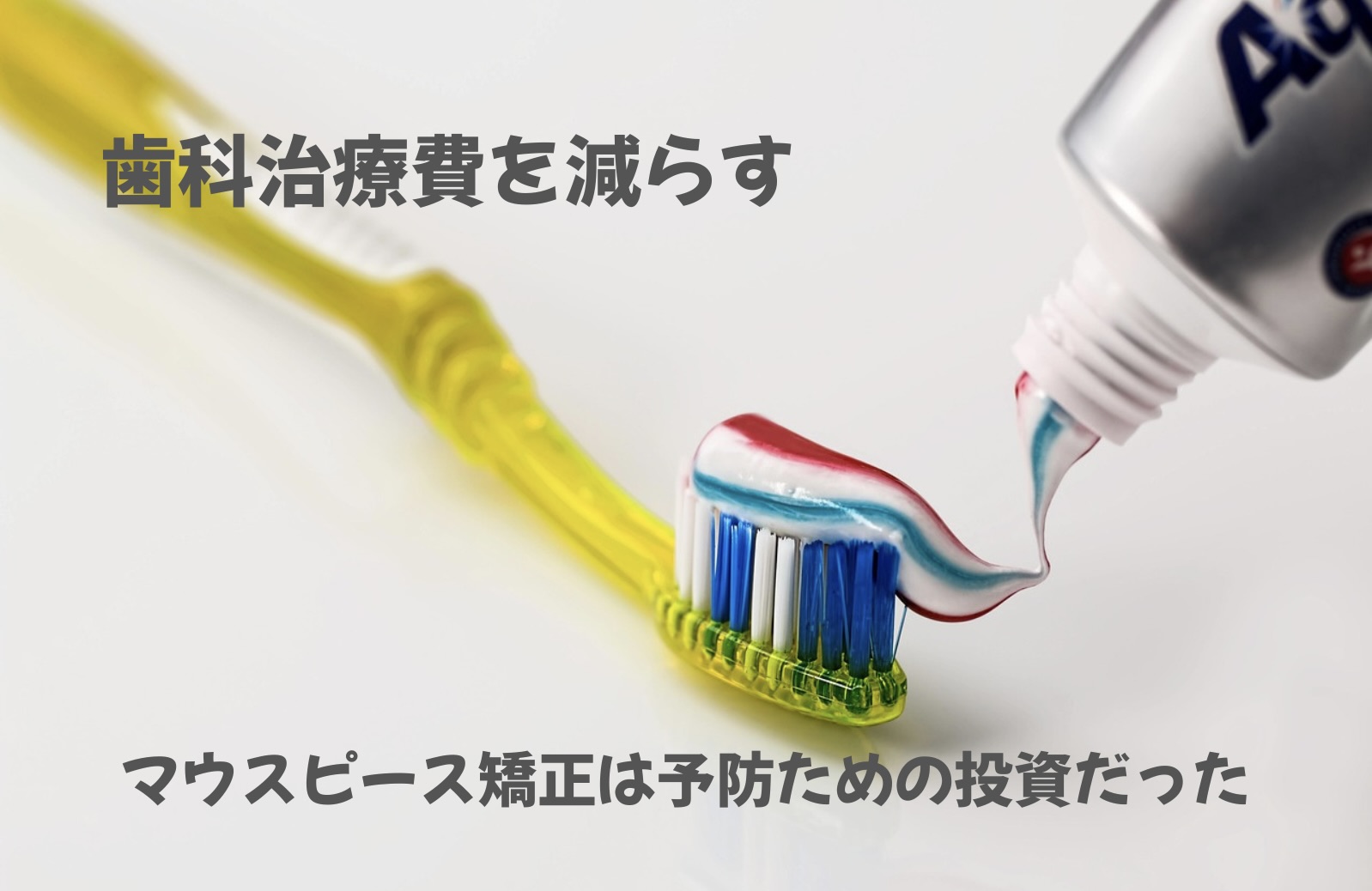 【最高の予防】早く始めるとモトが取れる！マウスピース矯正に36万円の課金は高い？安い？