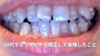 50代でマウスピース矯正して後悔したこと・よかったこと