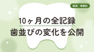 マウスピース矯正10ヶ月の全記録　50代のリアルな歯並び変化を写真で公開