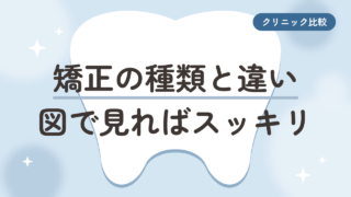 【見ればスッキリ】マウスピース矯正の種類と違いを図で解説。自分に合う相談先が分かる